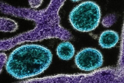 Çin’de chikungunya virüsü alarmı